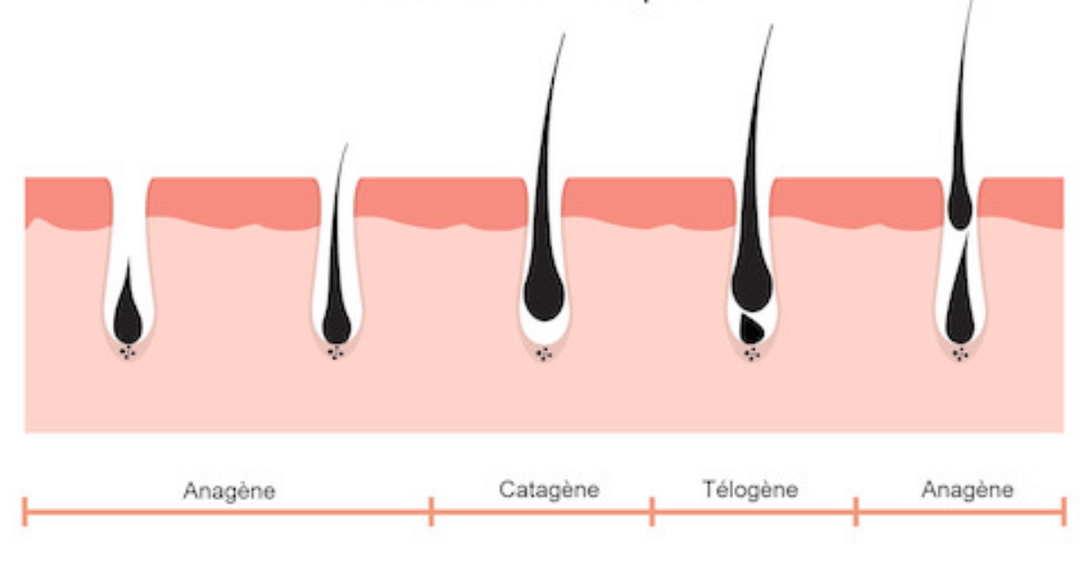 Pourquoi il faut plusieurs séances avant d'avoir des résultats pour l